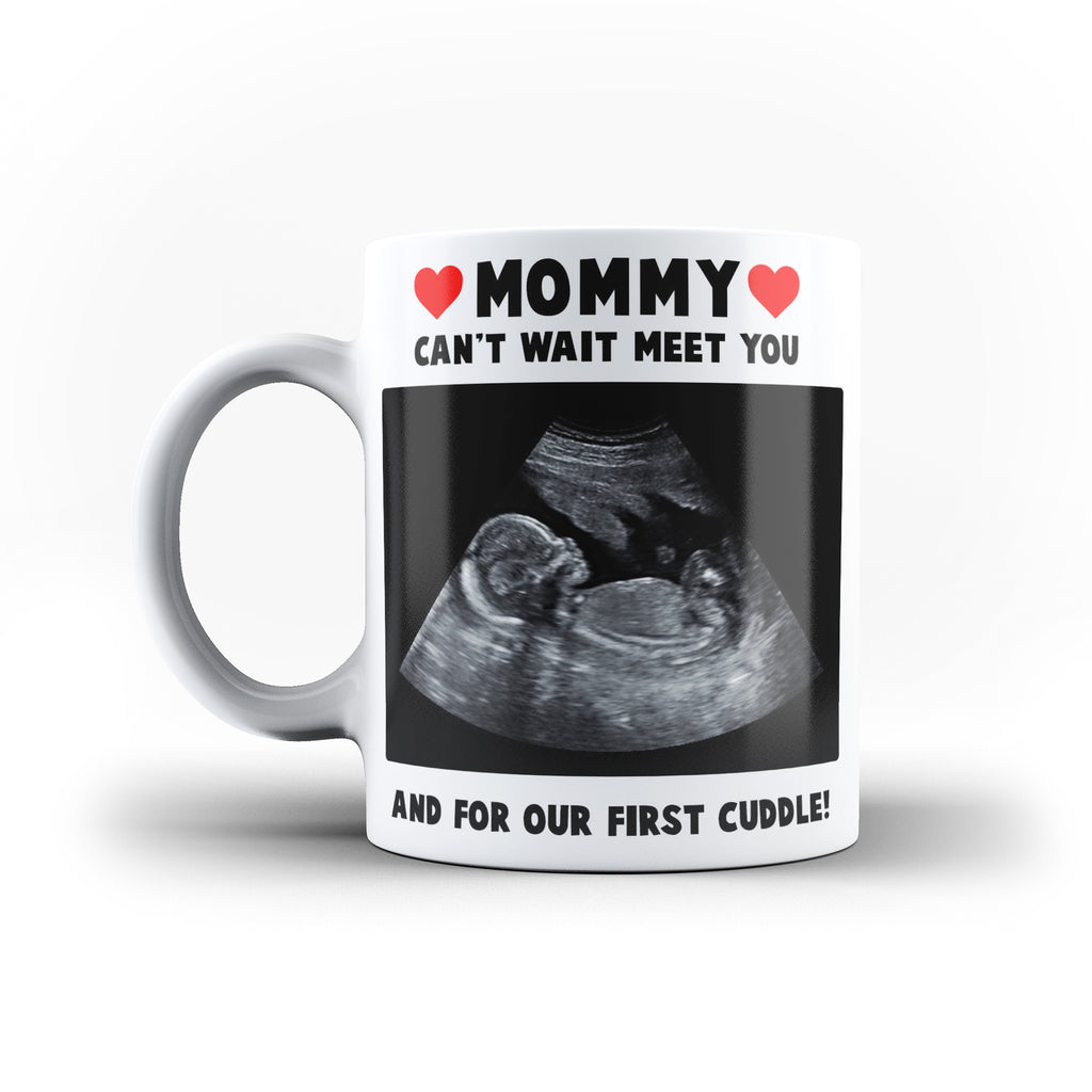 Personalised Baby Scan Photo Mug | Mother's Day Gift | Ai Printing